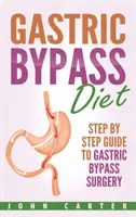 Dieta bypass gastric: Ghid pas cu pas pentru operația de bypass gastric - Gastric Bypass Diet: Step By Step Guide to Gastric Bypass Surgery