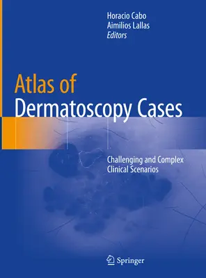 Atlas de cazuri de dermatoscopie: Scenarii clinice provocatoare și complexe - Atlas of Dermatoscopy Cases: Challenging and Complex Clinical Scenarios