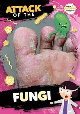 Atacul ciupercilor - Attack of the Fungi