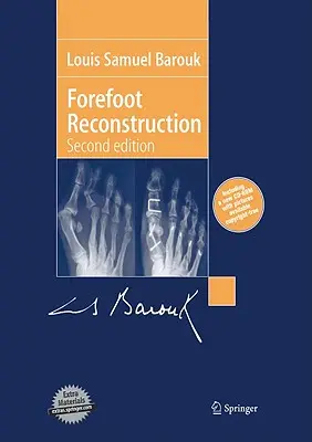 Reconstrucția antepiciorului - Forefoot Reconstruction
