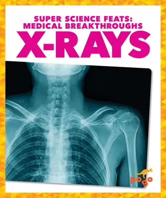 Razele X - X-Rays