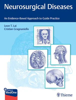 Boli neurochirurgicale: O abordare bazată pe dovezi pentru a ghida practica - Neurosurgical Diseases: An Evidence-Based Approach to Guide Practice