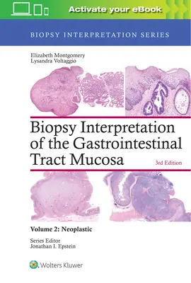 Interpretarea biopsiei mucoasei tractului gastrointestinal: Volumul 2: Neoplastic - Biopsy Interpretation of the Gastrointestinal Tract Mucosa: Volume 2: Neoplastic