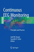 Monitorizarea continuă a Eeg: Principii și practică - Continuous Eeg Monitoring: Principles and Practice