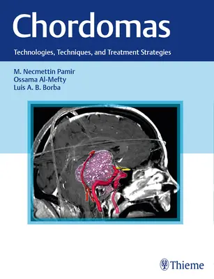 Chordomas: Tehnologii, tehnici și strategii de tratament - Chordomas: Technologies, Techniques, and Treatment Strategies