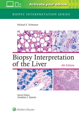 Interpretarea biopsiilor hepatice - Biopsy Interpretation of the Liver
