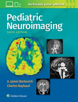 Neuroimagistică pediatrică - Pediatric Neuroimaging