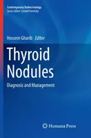 Noduli tiroidieni: Diagnosis and Management - Thyroid Nodules: Diagnosis and Management