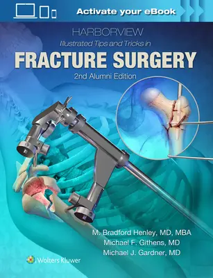 Harborview Sfaturi și trucuri ilustrate în chirurgia fracturilor - Harborview Illustrated Tips and Tricks in Fracture Surgery