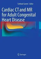 Cardiac CT and MR for Adult Congenital Heart Disease (CT și RMN cardiace pentru bolile cardiace congenitale la adulți) - Cardiac CT and MR for Adult Congenital Heart Disease
