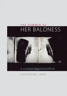 Vara chelirii ei: O improvizație despre cancer - The Summer of Her Baldness: A Cancer Improvisation