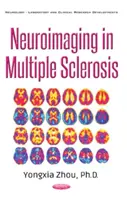 Neuroimagistică în scleroza multiplă - Neuroimaging in Multiple Sclerosis