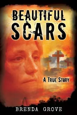 Cicatrici frumoase - Beautiful Scars