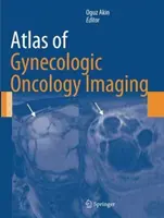 Atlas de imagistică în ginecologie oncologică (Atlas of Gynecologic Oncology Imaging) - Atlas of Gynecologic Oncology Imaging