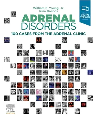Tulburările suprarenale: 100 Cases from the Adrenal Clinic (100 de cazuri din clinica suprarenală) - Adrenal Disorders: 100 Cases from the Adrenal Clinic
