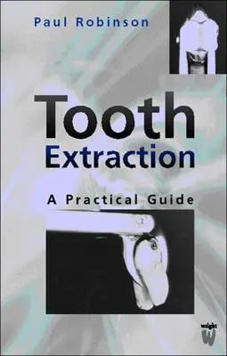 Extracția dinților: Un ghid practic - Tooth Extraction: A Practical Guide