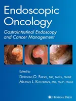 Oncologie endoscopică - Endoscopic Oncology