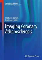 Imagistica aterosclerozei coronariene - Imaging Coronary Atherosclerosis