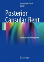 Renta capsulară posterioară: geneză și gestionare - Posterior Capsular Rent: Genesis and Management