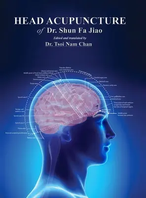 Acupunctura de cap a Dr. Shun Fa Jiao - Head Acupuncture of Dr. Shun Fa Jiao