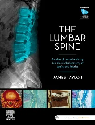 Coloana vertebrală lombară: Un atlas al anatomiei normale și al anatomiei morbide a îmbătrânirii și a leziunilor - The Lumbar Spine: An Atlas of Normal Anatomy and the Morbid Anatomy of Ageing and Injury
