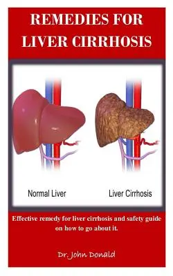 Remedii pentru ciroza hepatică: Remedii eficiente pentru ciroza hepatică și ghid de siguranță cu privire la modul de a proceda - Remedies For Liver Cirrhosis: Effective remedies for liver cirrhosis and safety guide on how to go about it