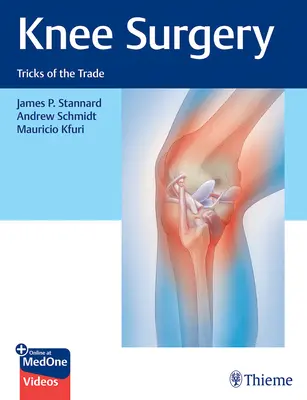 Chirurgia genunchiului: Trucuri ale meseriei - Knee Surgery: Tricks of the Trade