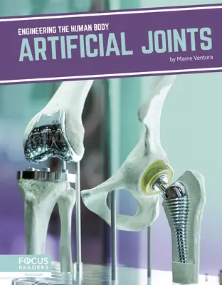 Articulații artificiale - Artificial Joints