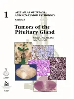 Tumori ale glandei pituitare - Tumors of the Pituitary Gland
