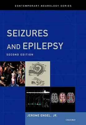 Convulsii și epilepsie - Seizures and Epilepsy