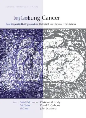 Cancerul pulmonar: Biologia bolii și potențialul său de traducere clinică - Lung Cancer: Disease Biology and Its Potential for Clinical Translation