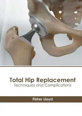 Înlocuirea totală a șoldului: Tehnici și complicații - Total Hip Replacement: Techniques and Complications