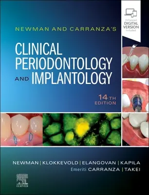 Parodontologia clinică și implantologia lui Newman și Carranza - Newman and Carranza's Clinical Periodontology and Implantology