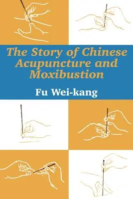 Povestea acupuncturii chineze și a moxibustionului - The Story of Chinese Acupuncture and Moxibustion