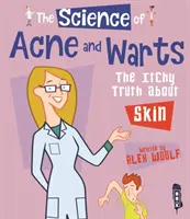 Știința acneei și a negilor - Adevărul despre mâncărime la nivelul pielii - Science of Acne & Warts - The Itchy Truth About Skin