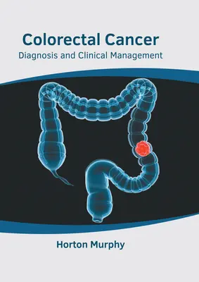 Cancer colorectal: Diagnostic și management clinic - Colorectal Cancer: Diagnosis and Clinical Management