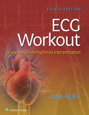 Antrenament ECG: Exerciții de interpretare a aritmiei - ECG Workout: Exercises in Arrhythmia Interpretation