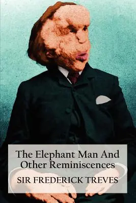 The Elephant Man și alte amintiri - The Elephant Man and Other Reminiscences