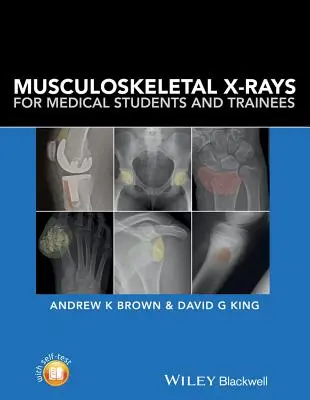 Radiografii musculo-scheletice pentru studenții și stagiarii în medicină - Musculoskeletal X-Rays for Medical Students and Trainees