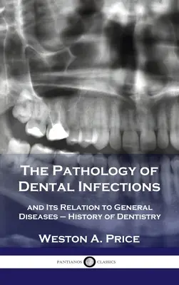 Patologia infecțiilor dentare: și relația sa cu bolile generale - Istoria stomatologiei - Pathology of Dental Infections: and Its Relation to General Diseases - History of Dentistry