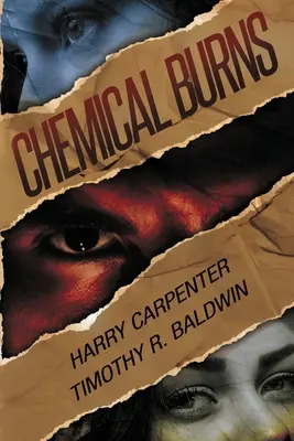 Arsuri chimice - Chemical Burns