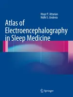 Atlas de electroencefalografie în medicina somnului - Atlas of Electroencephalography in Sleep Medicine