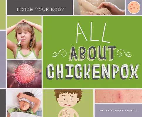 Totul despre varicelă - All about Chickenpox