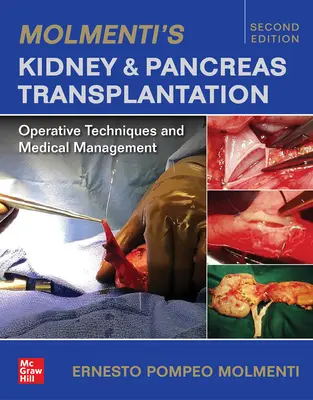 Molmenti's Kidney and Pancreas Transplantation: Tehnici operatorii și management medical - Molmenti's Kidney and Pancreas Transplantation: Operative Techniques and Medical Management
