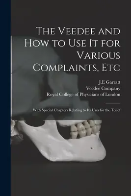 Veedee and How to Use It for Various Complaints, Etc: With Special Chapters Relating to Its Uses for the Toilet - The Veedee and How to Use It for Various Complaints, Etc: With Special Chapters Relating to Its Uses for the Toilet