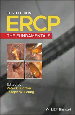 Ercp: Principiile de bază - Ercp: The Fundamentals