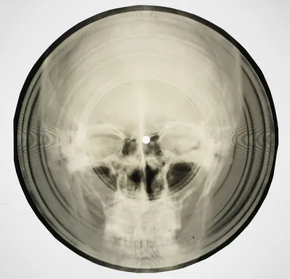 Bone Music: Soviet X-Ray Audio