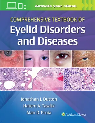 Manual cuprinzător de tulburări și boli ale pleoapelor (Comprehensive Textbook of Eyelid Disorders and Diseases) - Comprehensive Textbook of Eyelid Disorders and Diseases