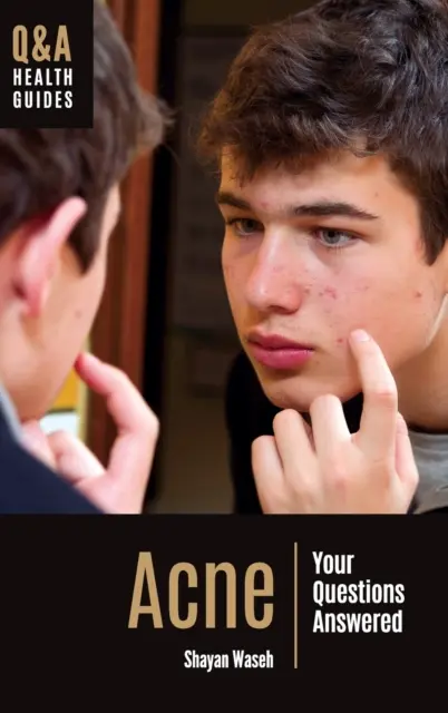 Acnee: răspuns la întrebările dumneavoastră - Acne: Your Questions Answered