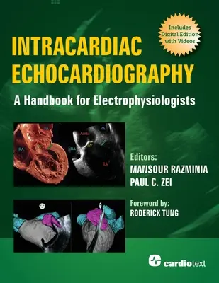 Intracardiac Echocardiography: Un manual pentru electrofiziologi - Intracardiac Echocardiography: A Handbook for Electrophysiologists